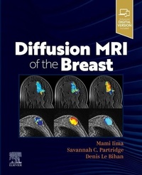 Enlarge image Cover: Diffusion MRI of the Breast - Elsevier