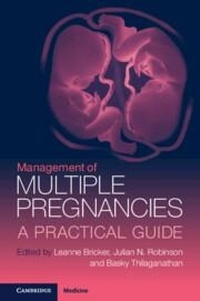 Abbildung von: Management of Multiple Pregnancies - Cambridge University Press