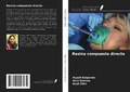 Cover: Resina compuesta directa - Ediciones Nuestro Conocimiento