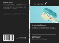 Abbildung von: Implantes basales - Ediciones Nuestro Conocimiento