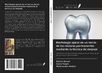 Abbildung von: Morfología apical de un tercio de los molares permanentes mediante la técnica de despeje - Ediciones Nuestro Conocimiento