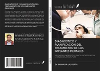 Abbildung von: DIAGNÓSTICO Y PLANIFICACIÓN DEL TRATAMIENTO DE LOS IMPLANTES DENTALES - Ediciones Nuestro Conocimiento