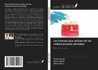 Abbildung von: Las fuerzas que actúan en las restauraciones dentales - Ediciones Nuestro Conocimiento