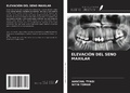 Cover: ELEVACI&Oacute;N DEL SENO MAXILAR - Ediciones Nuestro Conocimiento