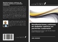 Cover: Manifestaciones cut&aacute;neas de diabetes mellitus en pacientes sudaneses - Ediciones Nuestro Conocimiento