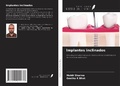 Cover: Implantes inclinados - Ediciones Nuestro Conocimiento
