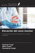Cover: Elevaci&oacute;n del seno maxilar - Ediciones Nuestro Conocimiento