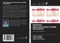 Enlarge image Cover: PRÓTESIS MAXILOFACIALES SOBRE IMPLANTES - Ediciones Nuestro Conocimiento