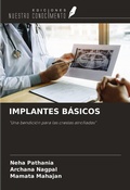 Cover: IMPLANTES B&Aacute;SICOS - Ediciones Nuestro Conocimiento