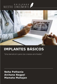 Enlarge image Cover: IMPLANTES BÁSICOS - Ediciones Nuestro Conocimiento