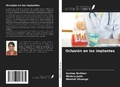 Cover: Oclusi&oacute;n en los implantes - Ediciones Nuestro Conocimiento