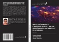 Cover: INFECCI&Oacute;N EN LA CAVIDAD BUCAL, EN LA REGI&Oacute;N DE LA CABEZA Y EL CUELLO - Ediciones Nuestro Conocimiento