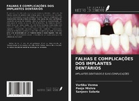 Enlarge image Cover: FALHAS E COMPLICAÇÕES DOS IMPLANTES DENTÁRIOS - Ediciones Nuestro Conocimiento