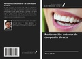Cover: Restauraci&oacute;n anterior de composite directo - Ediciones Nuestro Conocimiento