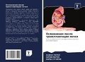 Cover: Oslozhneniq posle transplantacii pochki - Sciencia Scripts