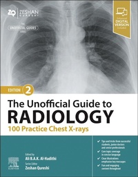Enlarge image Cover: The Unofficial Guide to Radiology: 100 Practice Chest X-rays - Churchill Livingstone
