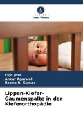 Cover: Lippen-Kiefer-Gaumenspalte in der Kieferorthop&auml;die - Verlag Unser Wissen