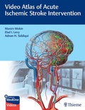 Abbildung von: Video Atlas of Acute Ischemic Stroke Intervention - Thieme Publishers