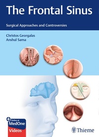 Abbildung von: The Frontal Sinus - Thieme