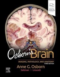 Abbildung von: Osborn's Brain - Churchill Livingstone