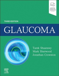 Enlarge image Cover: Glaucoma - Elsevier