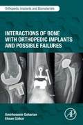 Cover: Interactions of Bone with Orthopedic Implants and Possible Failures - Academic Press