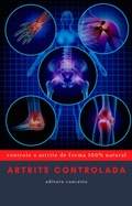 Cover: Artrite Controlada - Bibliomundi
