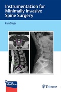 Cover: Instrumentation for Minimally Invasive Spine Surgery - Thieme Publishers
