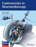 Cover: Controversies in Neuroendoscopy - Thieme Publishers