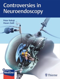 Abbildung von: Controversies in Neuroendoscopy - Thieme Publishers