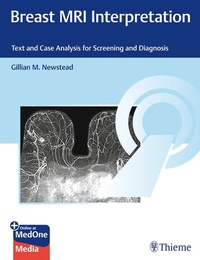 Abbildung von: Breast MRI Interpretation - Thieme Publishers