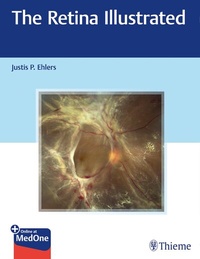 Abbildung von: The Retina Illustrated - Thieme Publishers