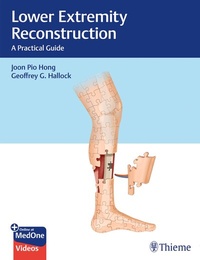 Enlarge image Cover: Lower Extremity Reconstruction - Thieme Publishers
