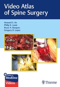 Cover: Video Atlas of Spine Surgery - Thieme Publishers