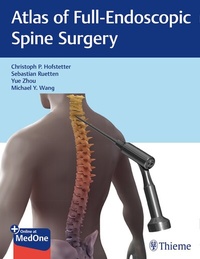 Abbildung von: Atlas of Full-Endoscopic Spine Surgery - Thieme Publishers