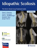 Cover: Idiopathic Scoliosis - Thieme Publishers