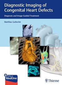 Abbildung von: Diagnostic Imaging of Congenital Heart Defects - Thieme