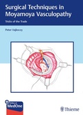 Cover: Surgical Techniques in Moyamoya Vasculopathy - Thieme