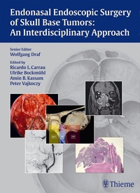 Abbildung von: Endonasal Endoscopic Surgery of Skull Base Tumors: An Interdisciplinary Approach - Thieme