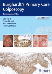 Abbildung von: Burghardt's Primary Care Colposcopy - Thieme