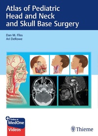 Abbildung von: Atlas of Pediatric Head and Neck and Skull Base Surgery - Thieme