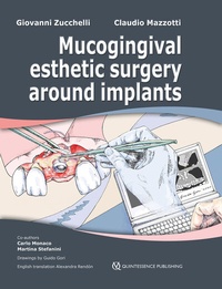 Abbildung von: Mucogingival Esthetic Surgery around Implants - Quintessenza Edizioni S.r.l.