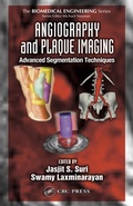 Cover: Angiography and Plaque Imaging - CRC Press
