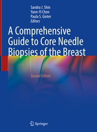 Abbildung von: A Comprehensive Guide to Core Needle Biopsies of the Breast - Springer