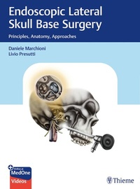 Abbildung von: Endoscopic Lateral Skull Base Surgery - Thieme