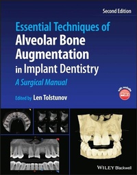 Abbildung von: Essential Techniques of Alveolar Bone Augmentation in Implant Dentistry - Wiley