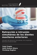 Cover: Retracci&oacute;n e intrusi&oacute;n simult&aacute;nea de los dientes maxilares anteriores - Ediciones Nuestro Conocimiento