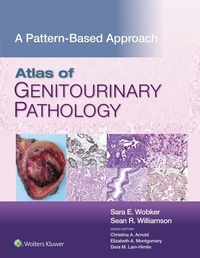 Abbildung von: Atlas of Genitourinary Pathology - Wolters Kluwer Health