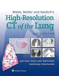 Abbildung von: Webb, Muller and Naidich's High-Resolution CT of the Lung - Wolters Kluwer Health