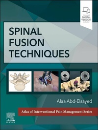 Abbildung von: Spinal Fusion Techniques - E-Book - Elsevier